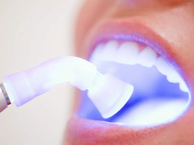 Soft Tissue Laser