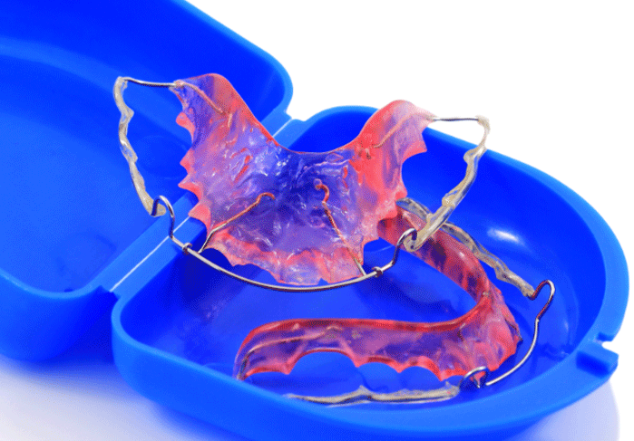 pink retainers in a blue case